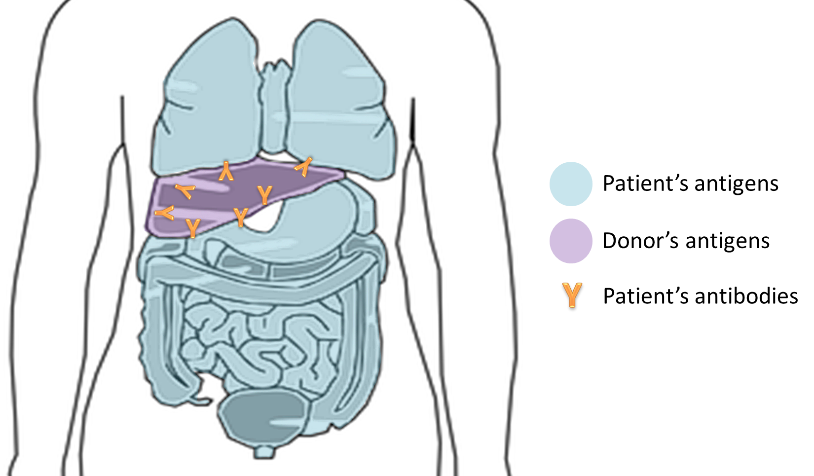 Blog-Biology-6-Difficult-Concepts-to-Master-for-the-HSC-Biology-Exam-Organ-Transplants