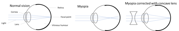 blog-biology-solutions-question-31-d-eyeball-image