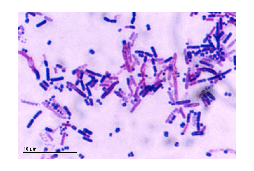 beginners-guide-year-11-biology-microscopy