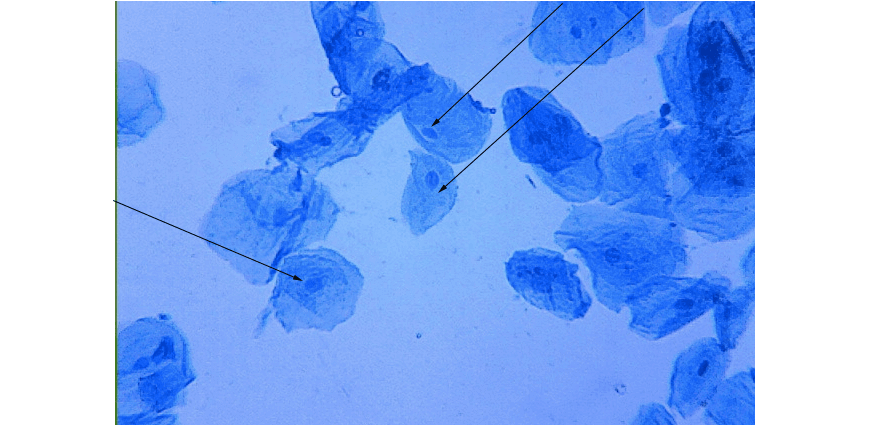 beginners-guide-year-11-biology-staining-techniques-microscopy-has-arrows