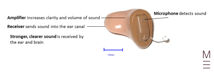 guide-biology-year-12-module-8-non-infectious-disease-and-disorders-hearing-aid