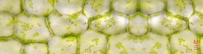 Close-up of plant cells with chloroplasts, relevant to the 2024 HSC Biology exam