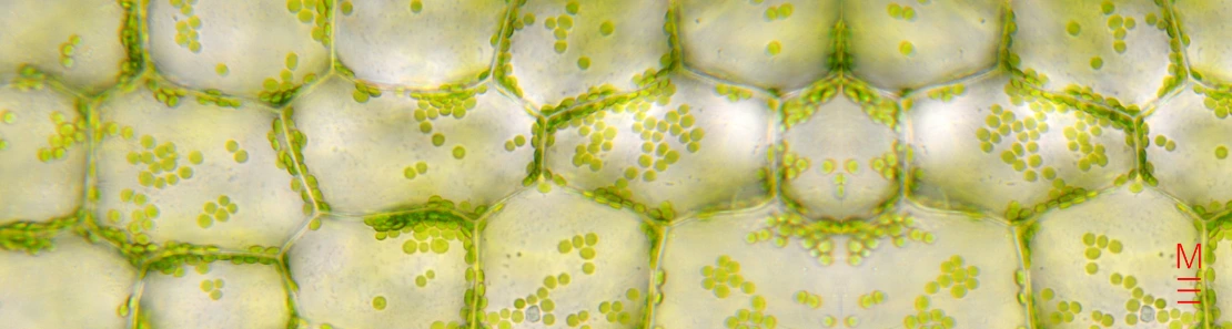 Close-up of plant cells with chloroplasts, relevant to the 2024 HSC Biology exam